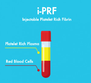 test tube graphic