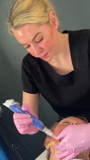Dr Steph carrying iPR microneedling treatment