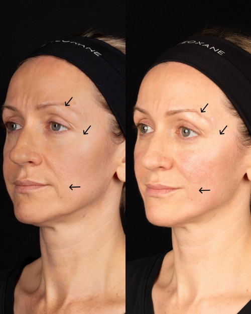 Beforeandafterbabyglowbyteoxaneimagefemale