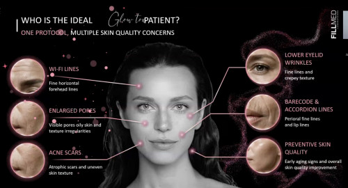 Glowtox treatment