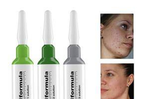 acne123