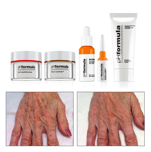 treatment_HANDS